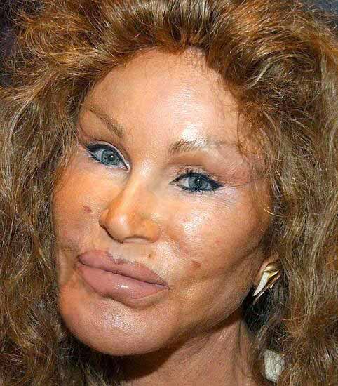 Bride-of-Wildenstein-botox.jpg