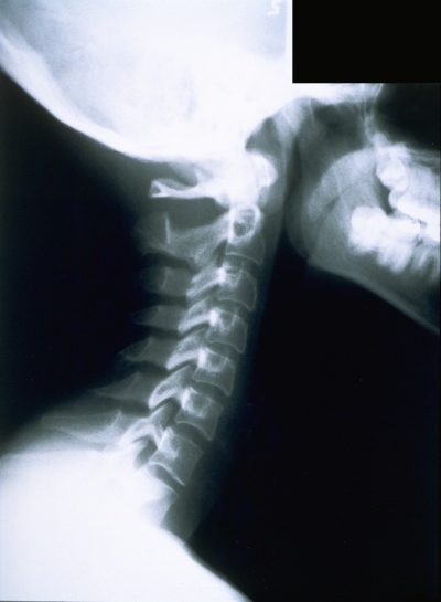 x-ray1f.jpg